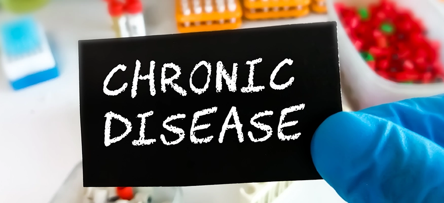 Modern Epidemic Rise Of Chronic Diseases And The Role Of Food